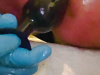 Analplug